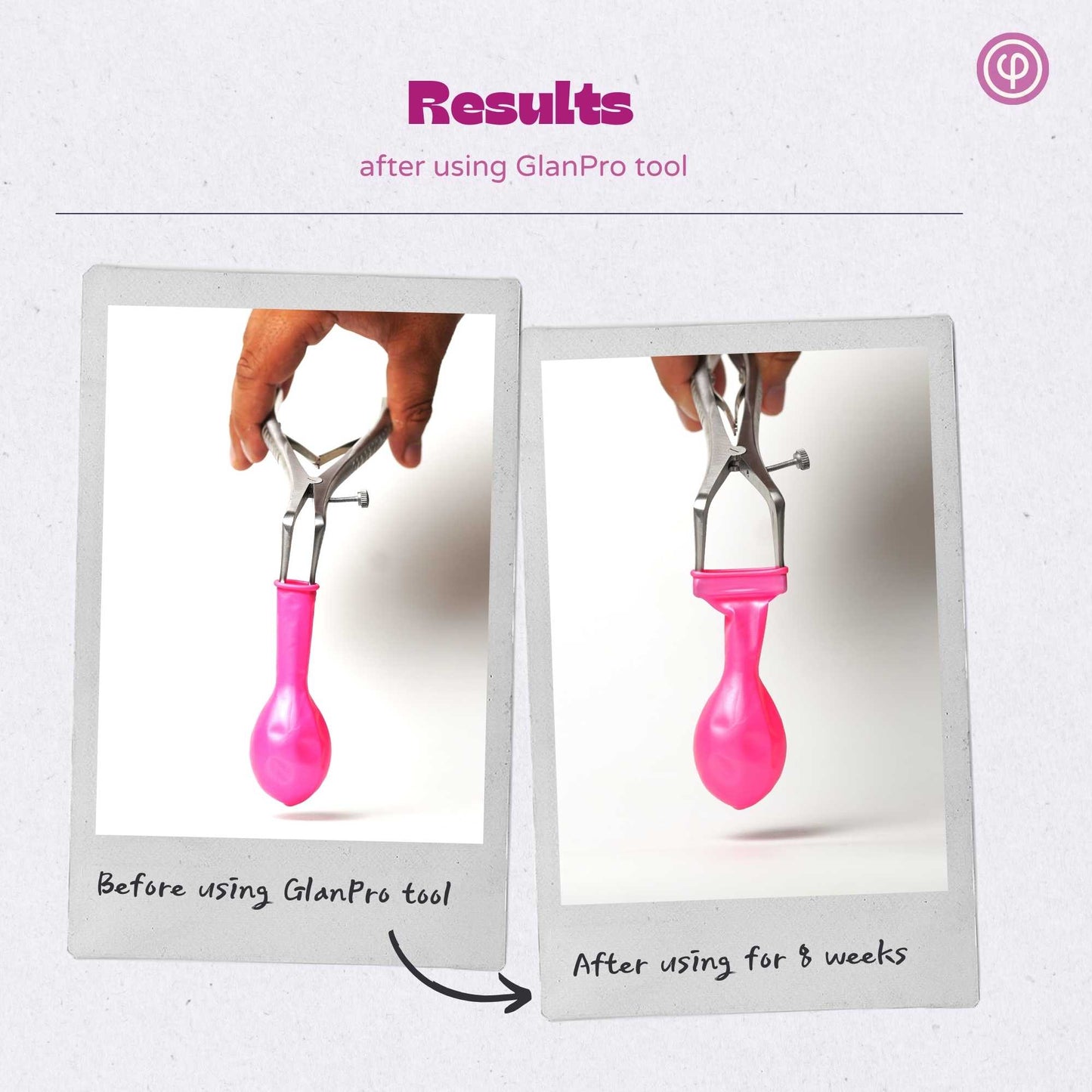 GlanPro - Stretching tool for phimosis - With Phimosis cream & Pouch